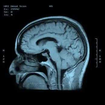 Study shows brain damage could make you a better investor