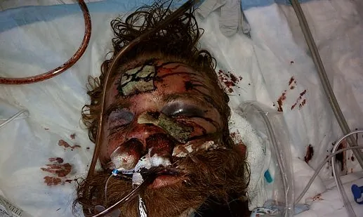 VIDEO: Cops get away with murder in the Land of the Free